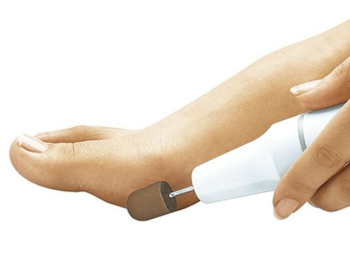 Fu&szlig;pflegeschleifkappen-Set, 11-teilig 