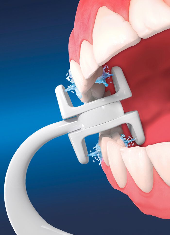 Zusatzaufs&auml;tze f&uuml;r Munddusche Corp Care Miracle Smile WEISS